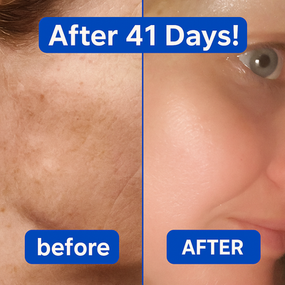 Heríva® Hyaluronic Acid Powder